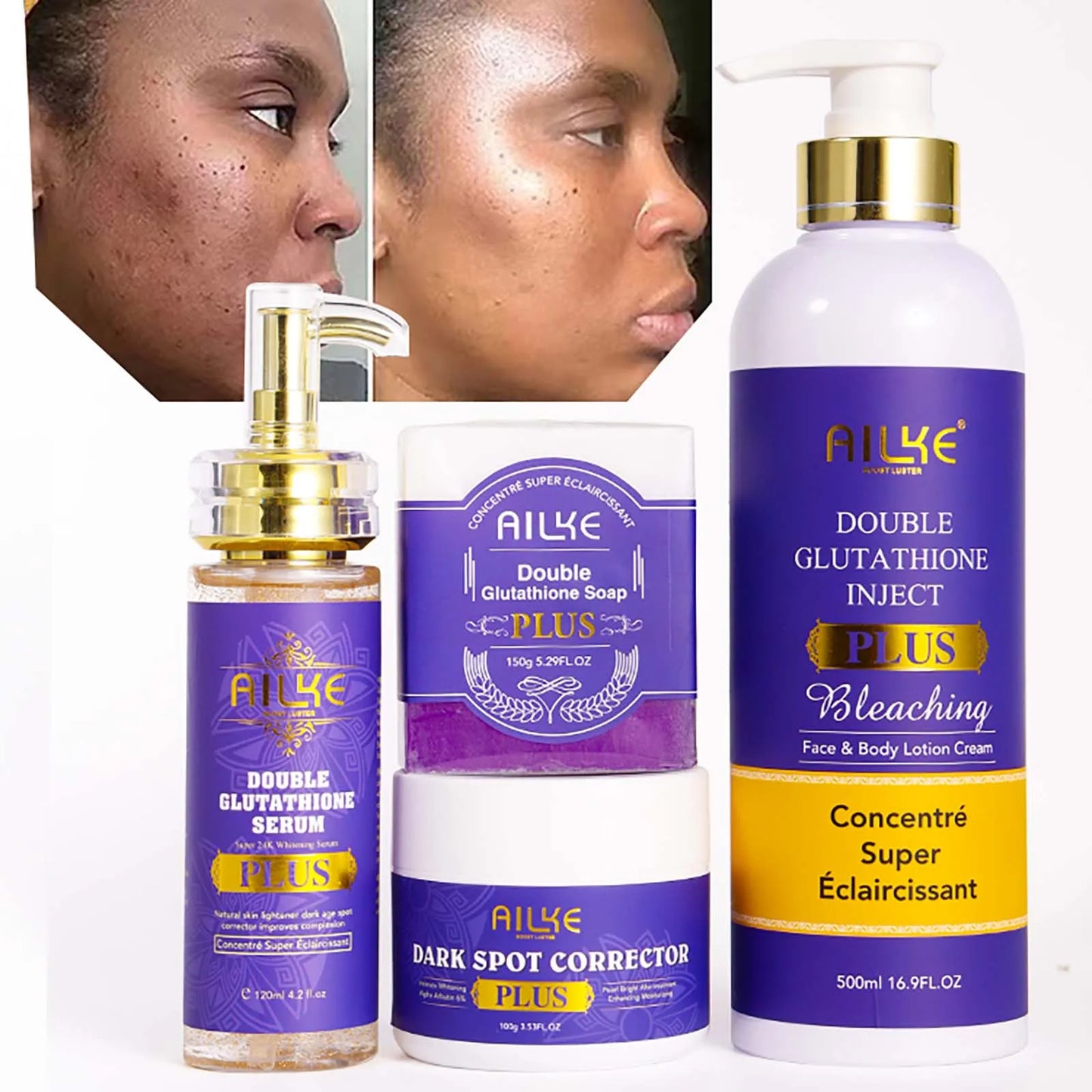 Hidratante Corporal – Melhora o tom da pele