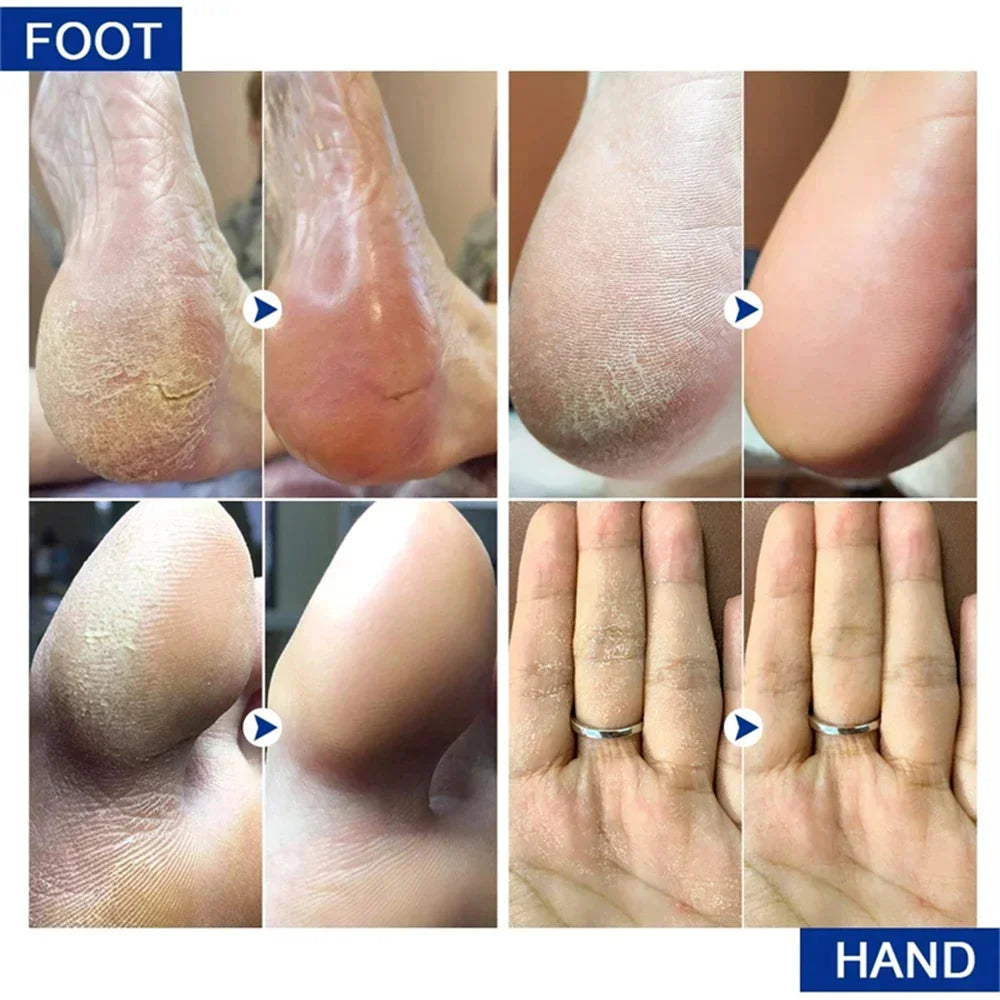 Creme para mãos – Colágeno anti-rugas