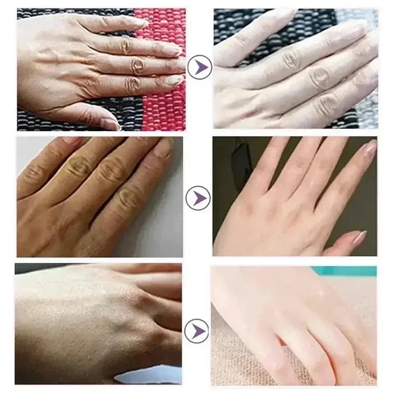Creme para remoção de rugas das mãos
