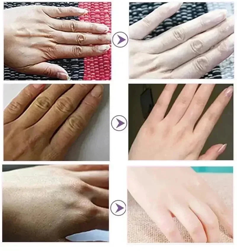 Creme para remoção de rugas das mãos