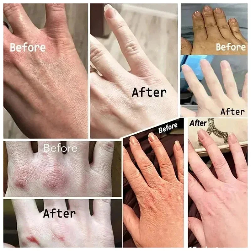 Creme para remoção de rugas das mãos