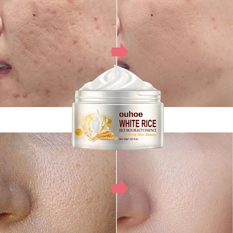 Creme facial anti-rugas de arroz