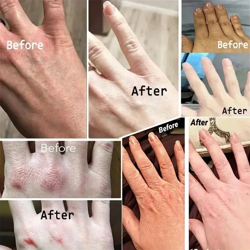 Creme para remoção de rugas das mãos