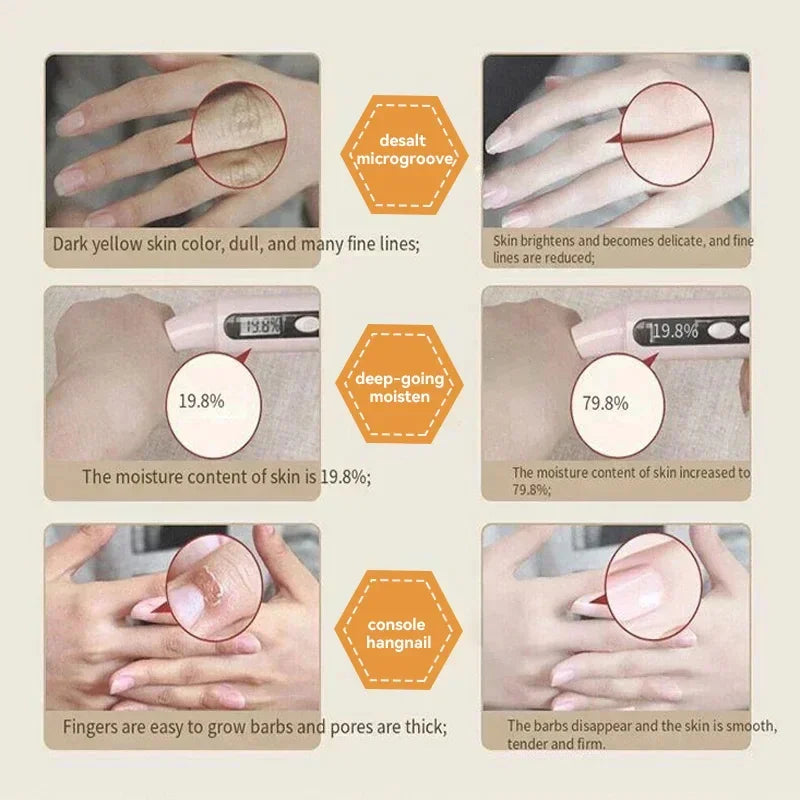 Creme para remoção de rugas das mãos